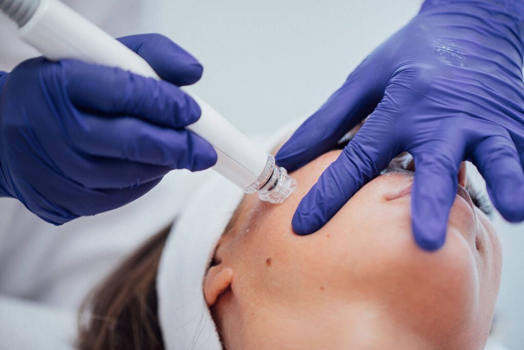 HYDRO FACIAL Huidverbetering