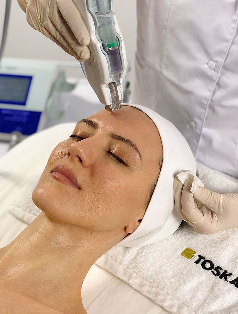 Mesojectgun Avance Skincare